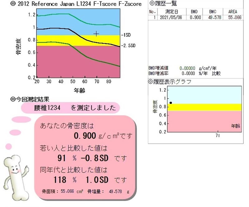 骨密度検査